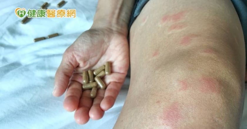 「最美周芷若」周海媚享年57歲 紅斑性狼瘡恐引發全身器官衰竭