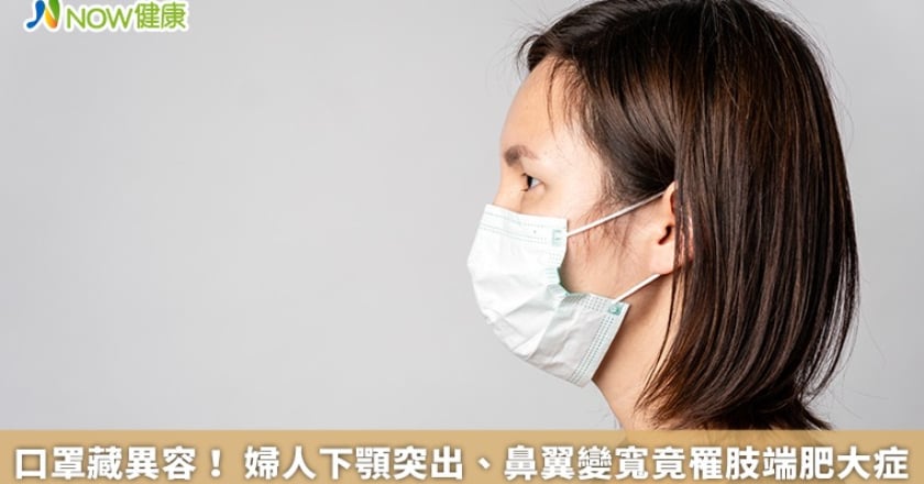 口罩藏異容！ 婦人下顎突出、鼻翼變寬竟罹肢端肥大症