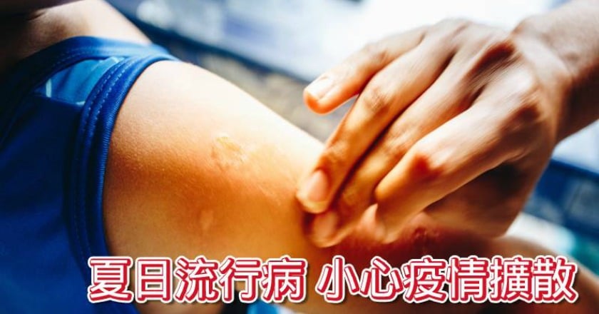 夏季傳染病升溫　藥師妙招防疫