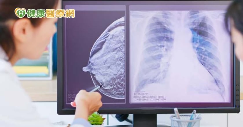 一次看！乳房X光攝影流程4步驟、異常結果處理指引　3異狀應盡速就醫