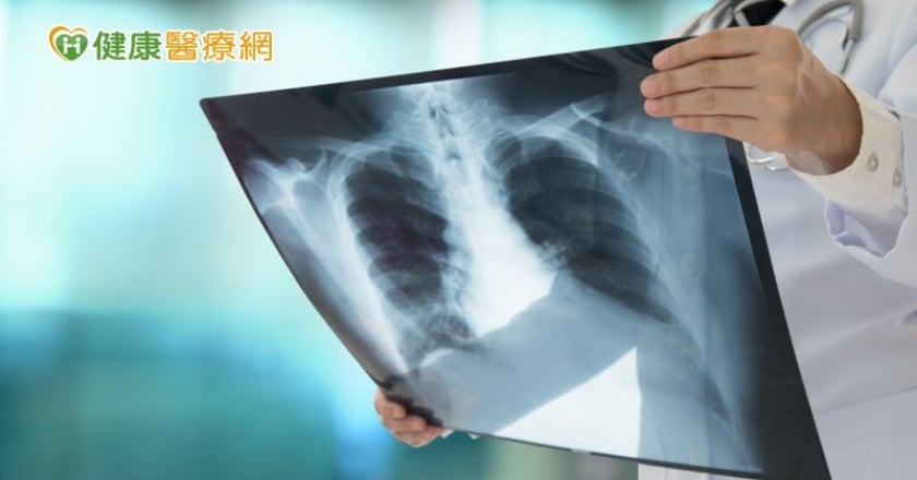 肺癌手術後要注意什麼？如何避免復發？ 醫師來解答！