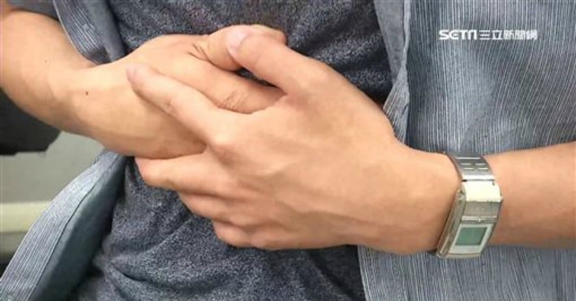 胰臟癌早期症狀不明顯 晚期死亡率高