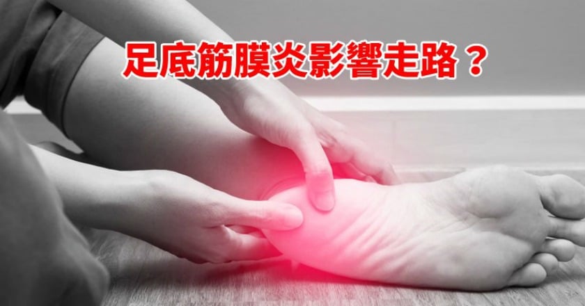 踩一步痛一步　 如何為足底筋膜炎解套？