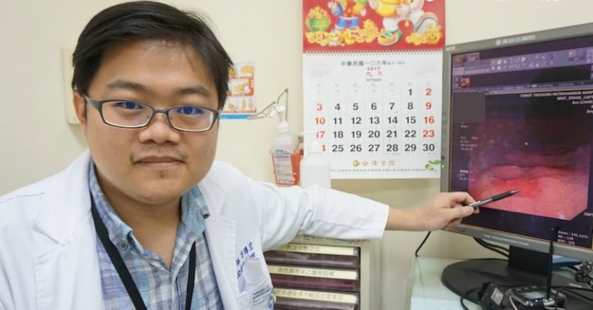 健檢揪出胃癌　內視鏡手術免開刀除腫瘤