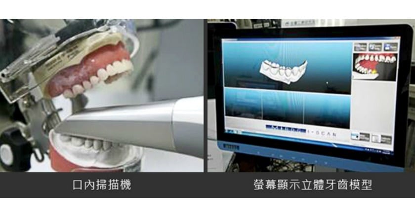 牙齒補缺學問大 治療前仔細評估可免醫糾