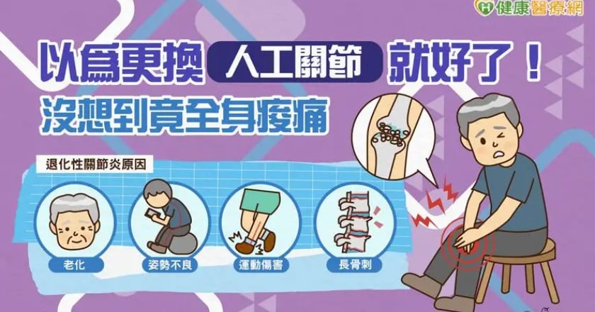 以為更換人工關節就好了！ 沒想到竟全身痠痛