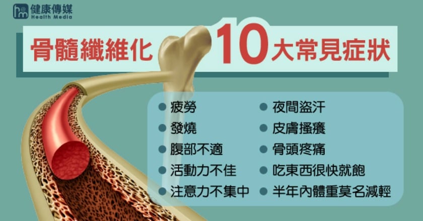 熟齡出現這10大症狀 當心罕病骨髓纖維化