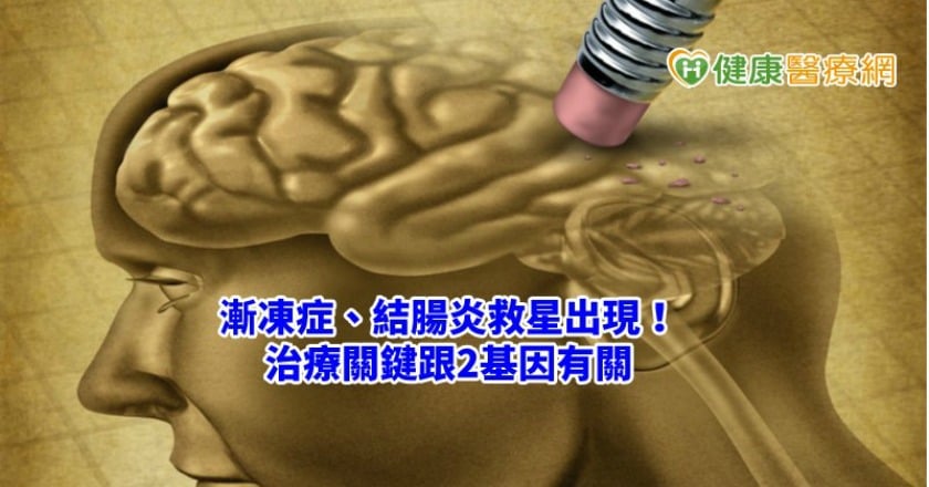 漸凍症、結腸炎救星出現! 治療關鍵跟2基因有關