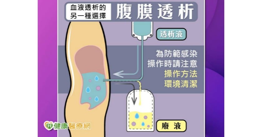 腹膜透析洗肚子 腎友救命該怎麼選?