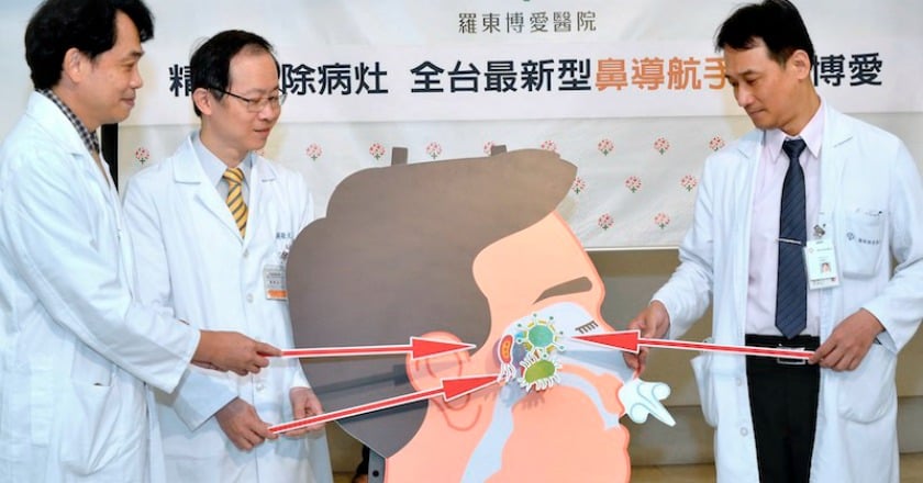 深受慢性鼻竇炎之苦　每四人就有一人