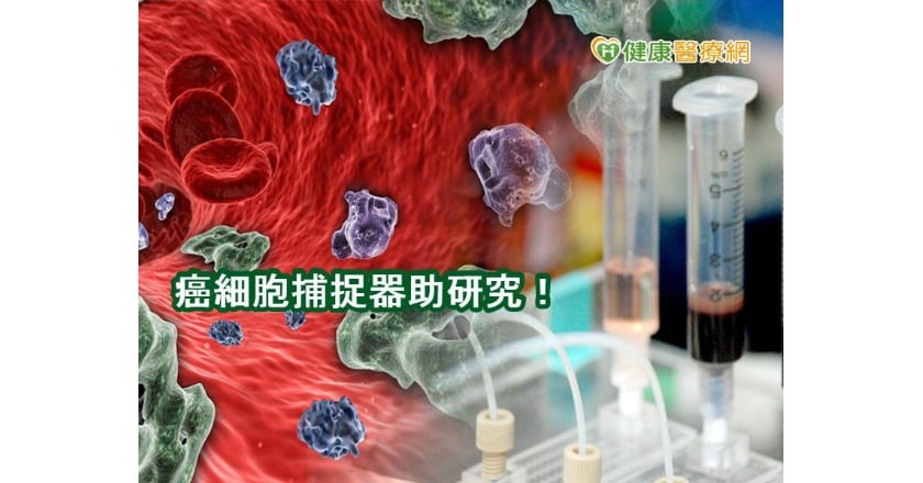 頭頸癌會集體遷徙　癌細胞捕捉器建功