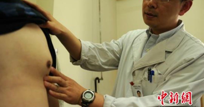 男人「胸肌」變「巨乳」 當心女乳症上身