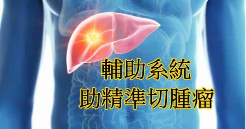 螢光顯影輔助系統　助醫師精準切腫瘤