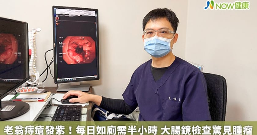 老翁痔瘡發紫！每日如廁需半小時 大腸鏡檢查驚見腫瘤