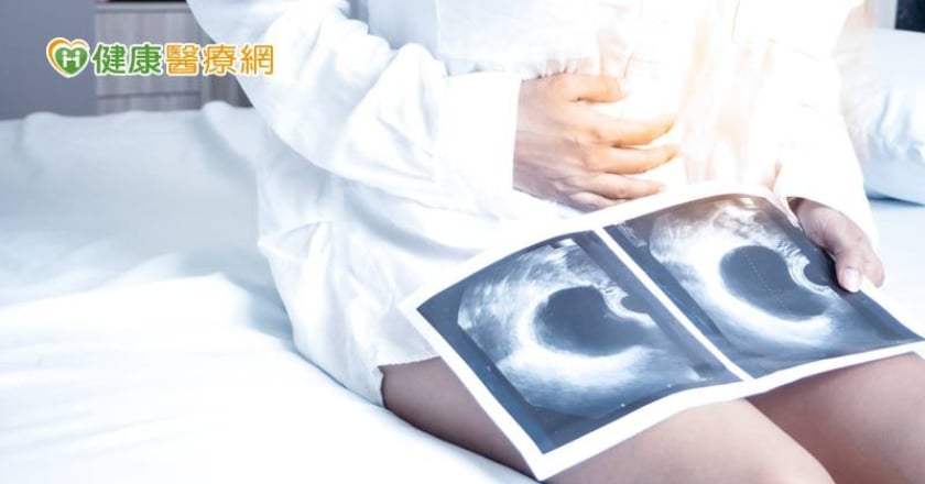5旬婦人變胖、呼吸喘 驚見巨大卵巢囊腫藏肚