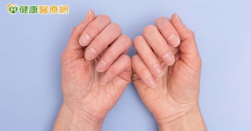 從指甲看健康警訊 可能是心肺出問題！小心顏色、形狀的異常變化