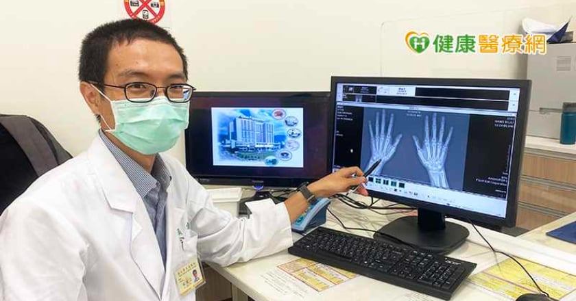 類風濕性關節炎纏身　險害烘焙師夢碎！