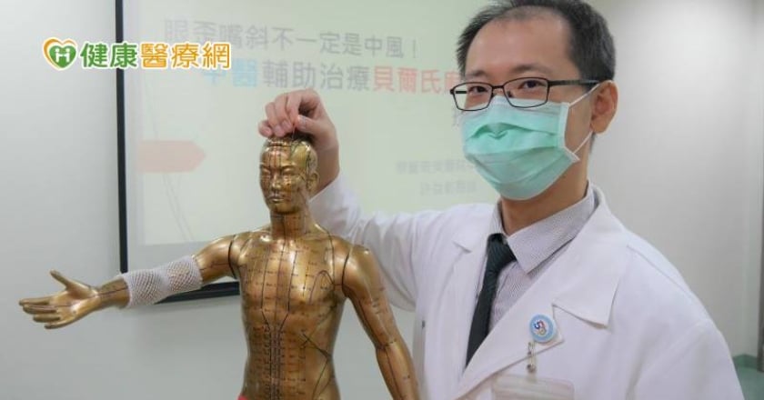 眼歪嘴斜當心是顏面神經麻痺！　中醫輔助治療恢復快