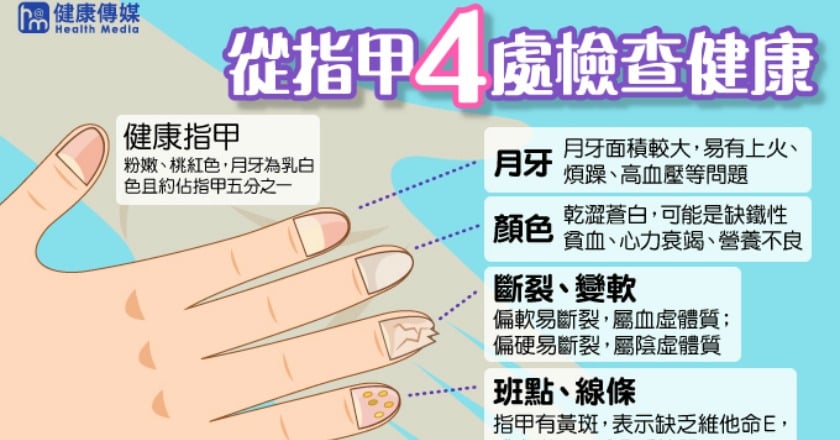 從指甲看健康 中醫師教你4處檢查