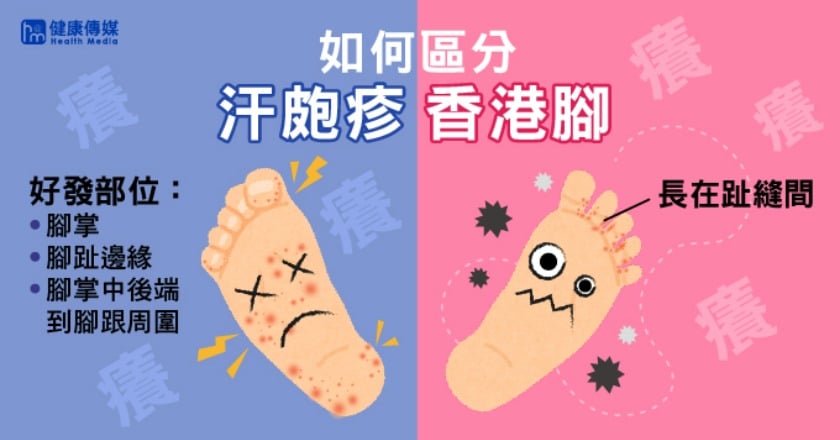 汗皰疹搔癢難耐 狂抓到破皮恐釀蜂窩性組織炎