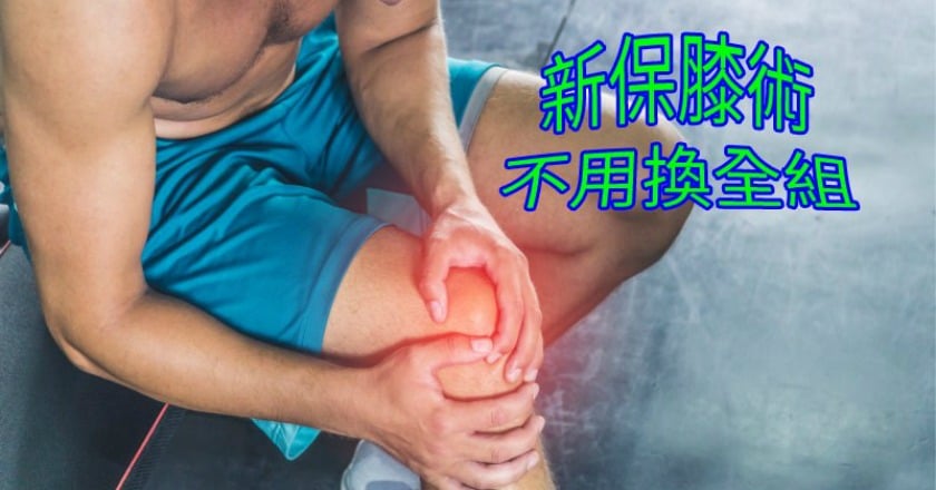 膝關節痛只能換關節? 新保膝術不用換全組