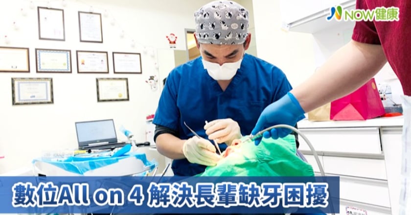 數位All on 4拯救大範圍缺牙 牙醫師也推薦給無牙老爸