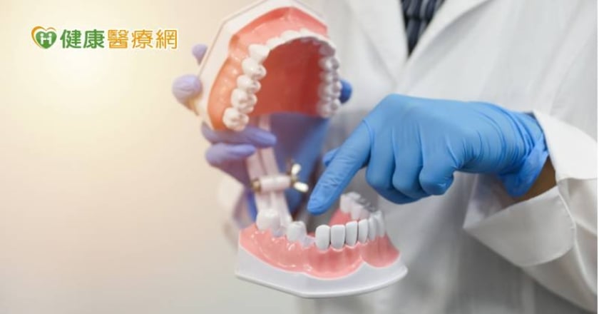 缺牙該植牙還是做活動假牙？　牙科醫師詳解