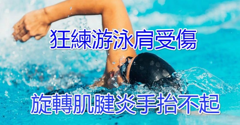 狂練游泳肩受傷 旋轉肌腱炎手抬不起