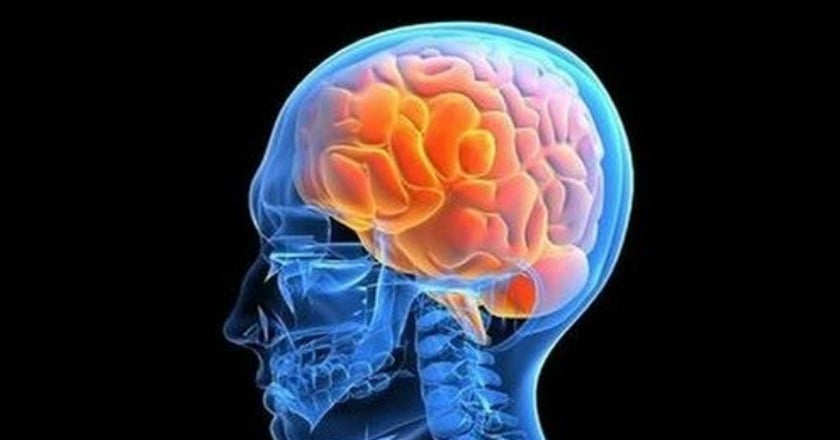 腦瘤分良惡　癲癇症狀最常見