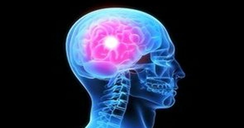 抗磷脂質症候群　恐致腦中風及反覆流產