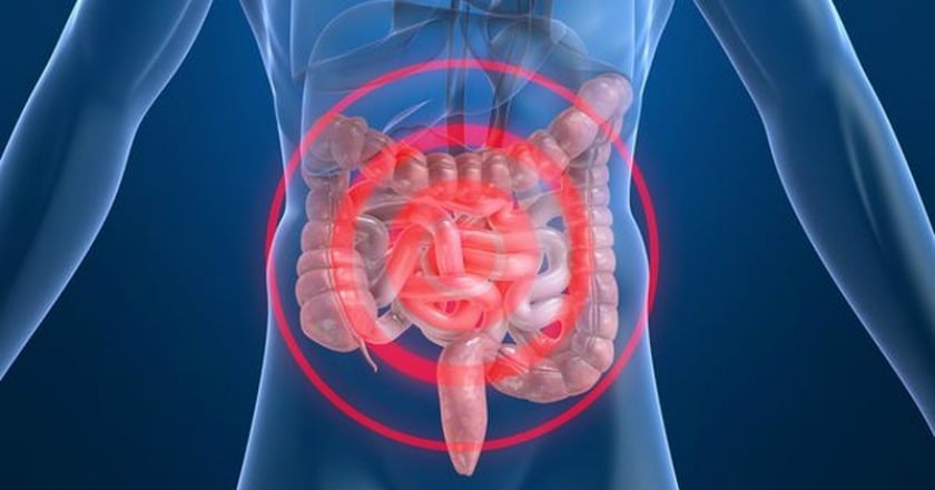 糞便潛血陽性快做大腸鏡 無痛檢查別害怕