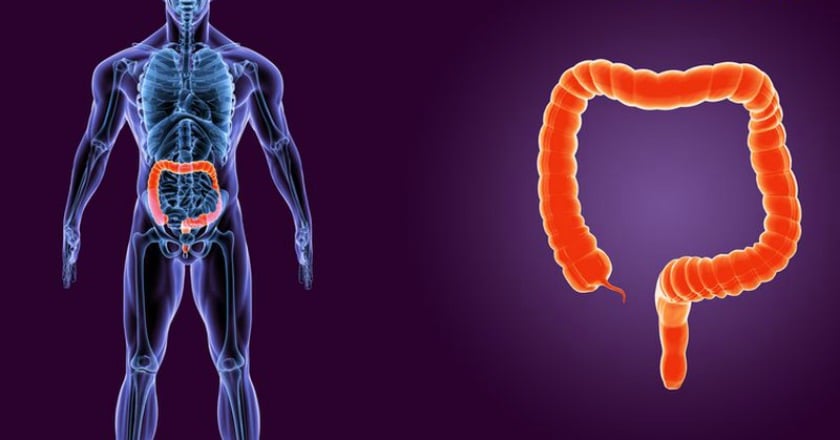 豬哥亮大腸癌拖成末期　「新國病」別輕忽！