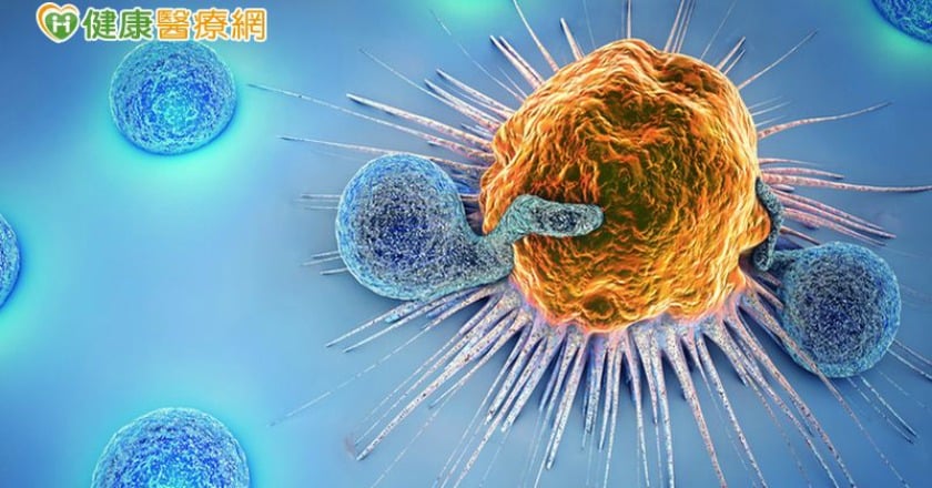 腎臟癌腦轉移　免疫療法抗癌立大功！