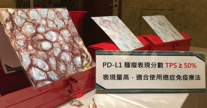 癌症療法更精準化　病理診斷不可少
