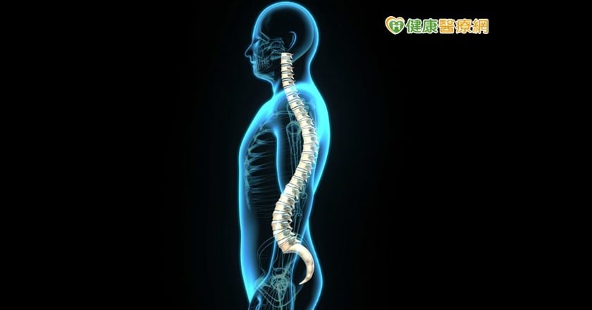 椎間盤突出長骨刺 何時需要手術?