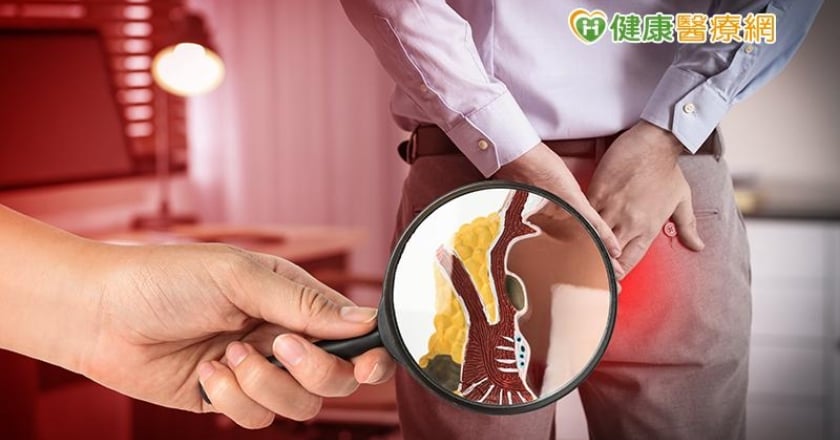 痔瘡會自然康復嗎？　醫師盤點４級治療法
