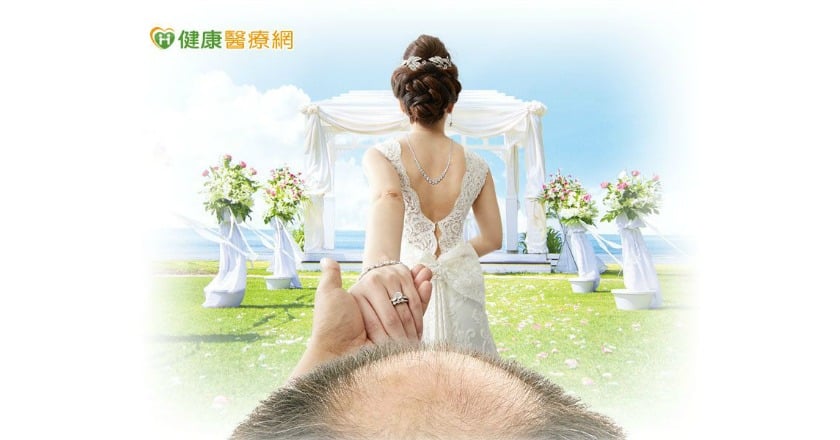 十禿九富？人生勝利組慘遭髮際線KO