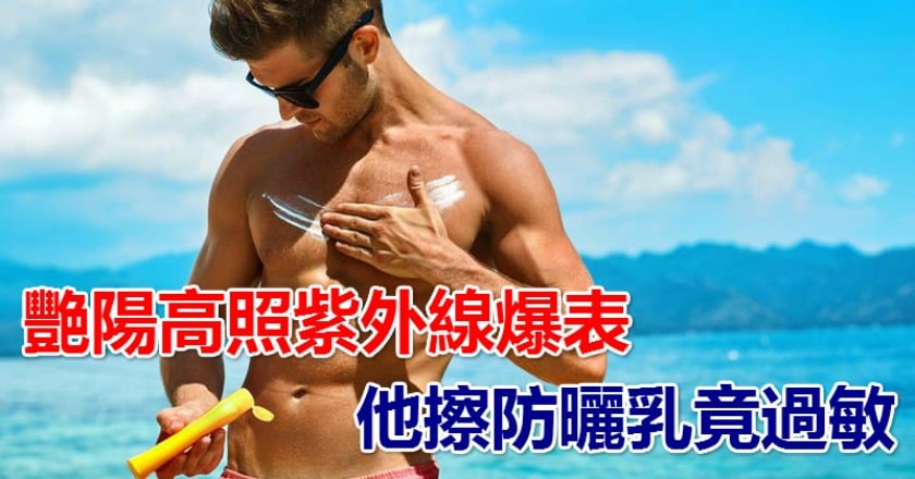 艷陽高照紫外線爆表 他擦防曬乳竟過敏