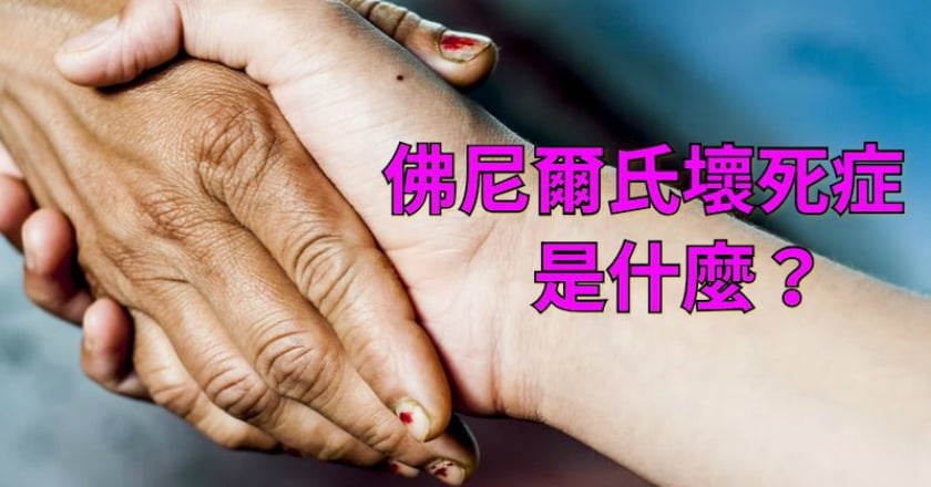 8旬翁腹側腫脹紅腫 竟是佛尼爾氏壞死症