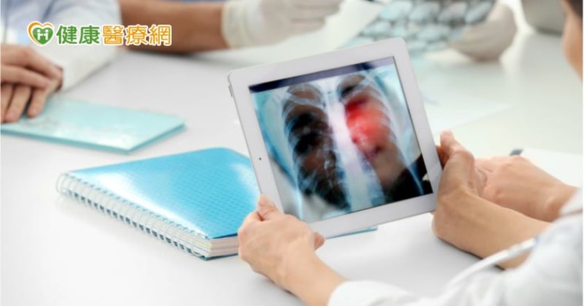 如何遠離肺癌找上門？　國健署教必學「顧肺４招」