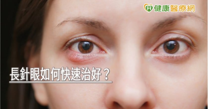 長針眼如何快速治好？　眼科名醫教1實用方法緩解症狀