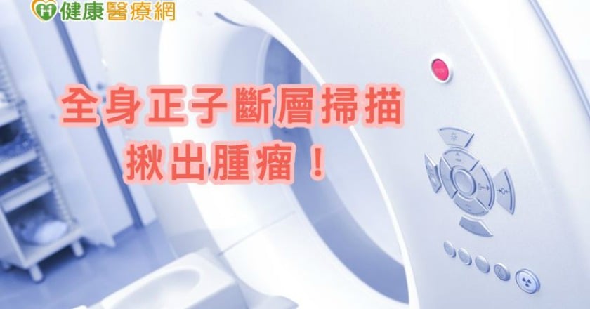 食道癌沈默難覺 正子斷層掃描助及早發現