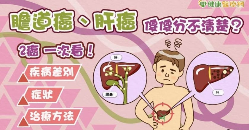 膽道癌、肝癌傻傻分不清楚？醫師帶你從腫瘤型態、症狀、治療了解！