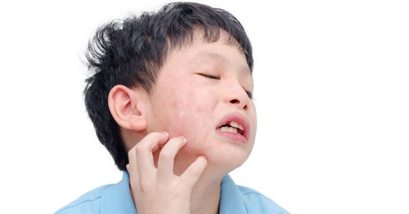 皮膚過敏癢又痛 免疫失衡怎麼辦?