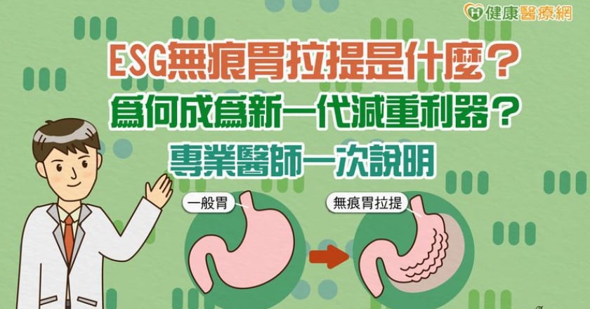 ESG無痕胃拉提是什麼？為何成為新一代減重利器？專業醫師一次說明