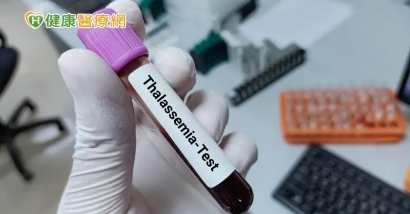 「地中海貧血」檢查很重要！　如何檢測？帶因者該怎麼辦？專家解答