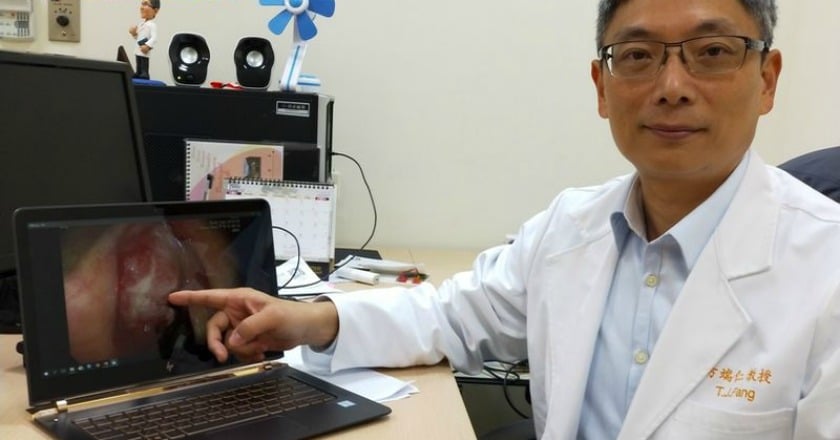 微創雷射手術治聲門癌 不怕日後沒聲音