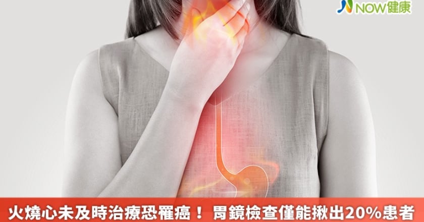 火燒心未及時治療恐罹癌! 胃鏡檢查僅能揪出20%患者