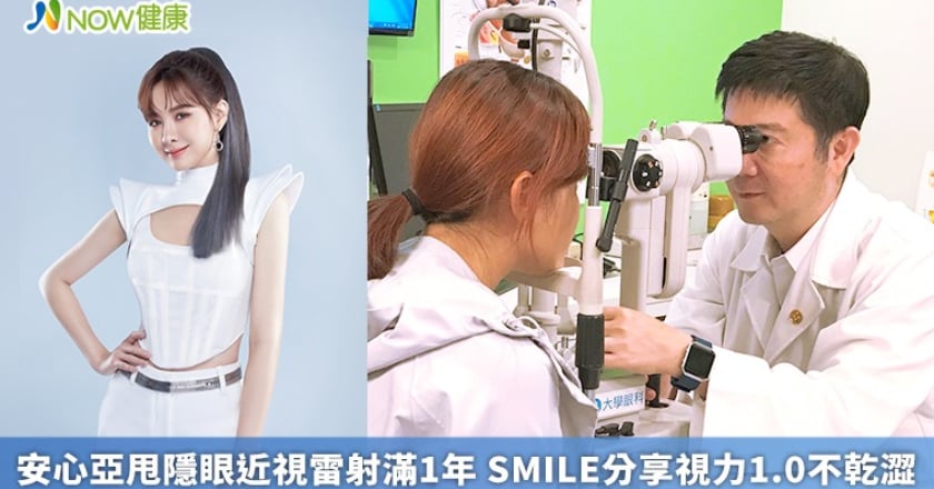 安心亞甩隱眼近視雷射滿1年 SMILE分享視力1.0不乾澀