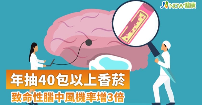 快戒了!年抽40包以上香菸 致命性腦中風機率增3倍